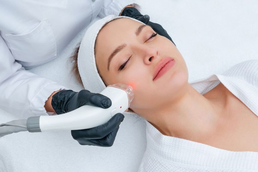 rejuvenecimiento facial con láser